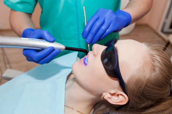 dental bonding being cured with ultraviolet lamp