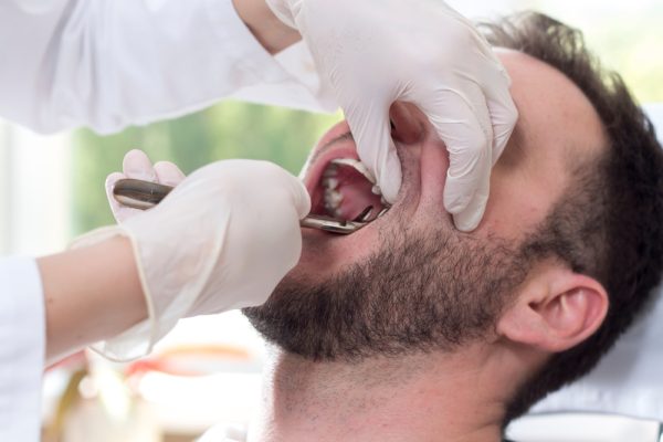 tooth extraction