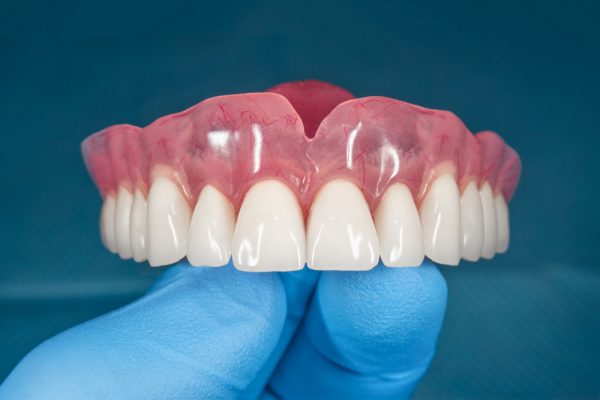 Complete dentures held by a gloved hand, showcasing a full arch of artificial teeth with pink acrylic base, representing Glenwood Dental Associates' denture services.