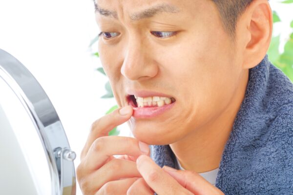 man checking gums and teeth